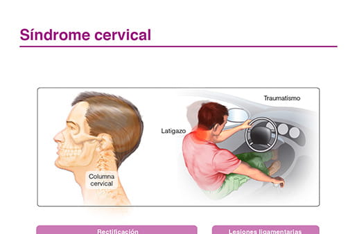 Síndrome cervical