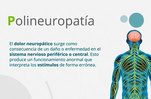 ¿Qué es y cómo se manifiesta el dolor neuropático?