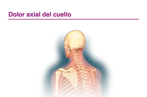 Dolor axial del cuello
