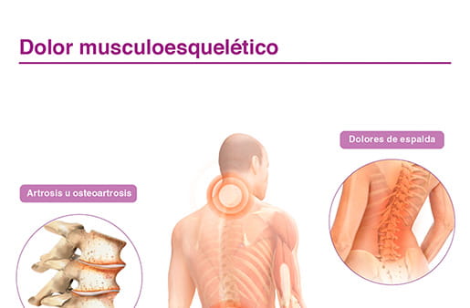 Dolor musculoesquelético