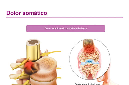 Dolor somático