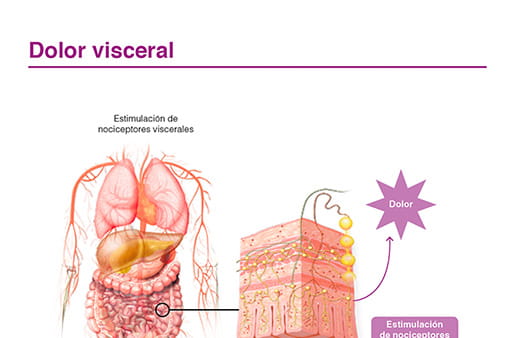 Dolor visceral