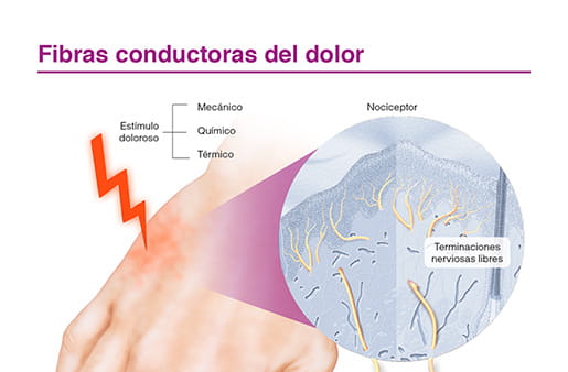 Fibras conductoras del dolor