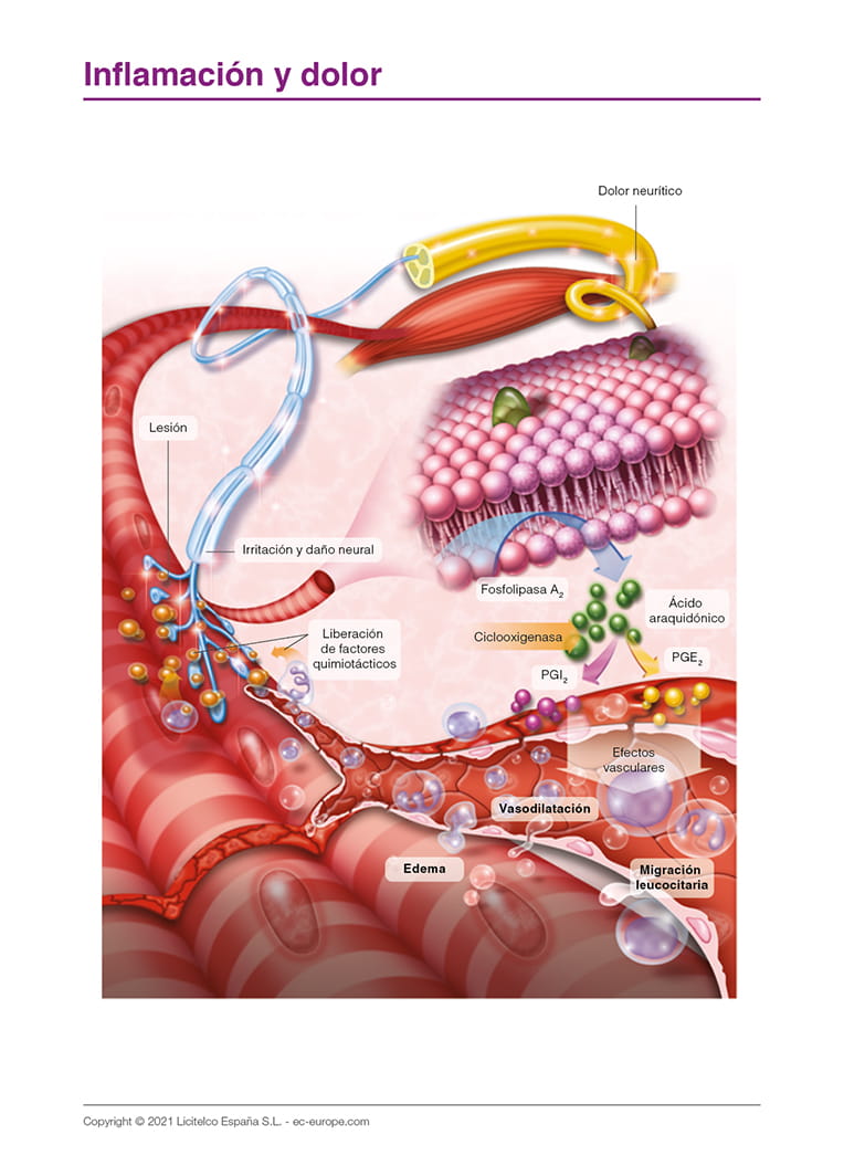 Inflamación y dolor