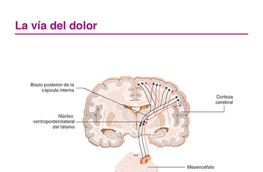 La vía del dolor