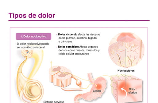 Tipos de dolor