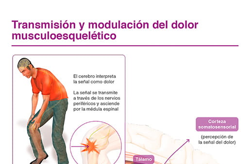 Transmisión y modulación del dolor musculoesquelético