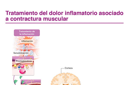 Tratamiento del dolor inflamatorio asociado a contractura muscular