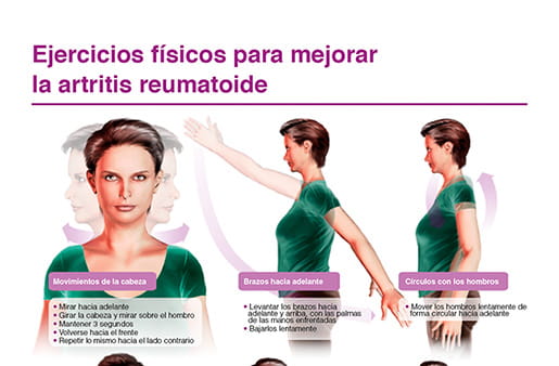 Ejercicios físicos para mejorar la artritis reumatoide