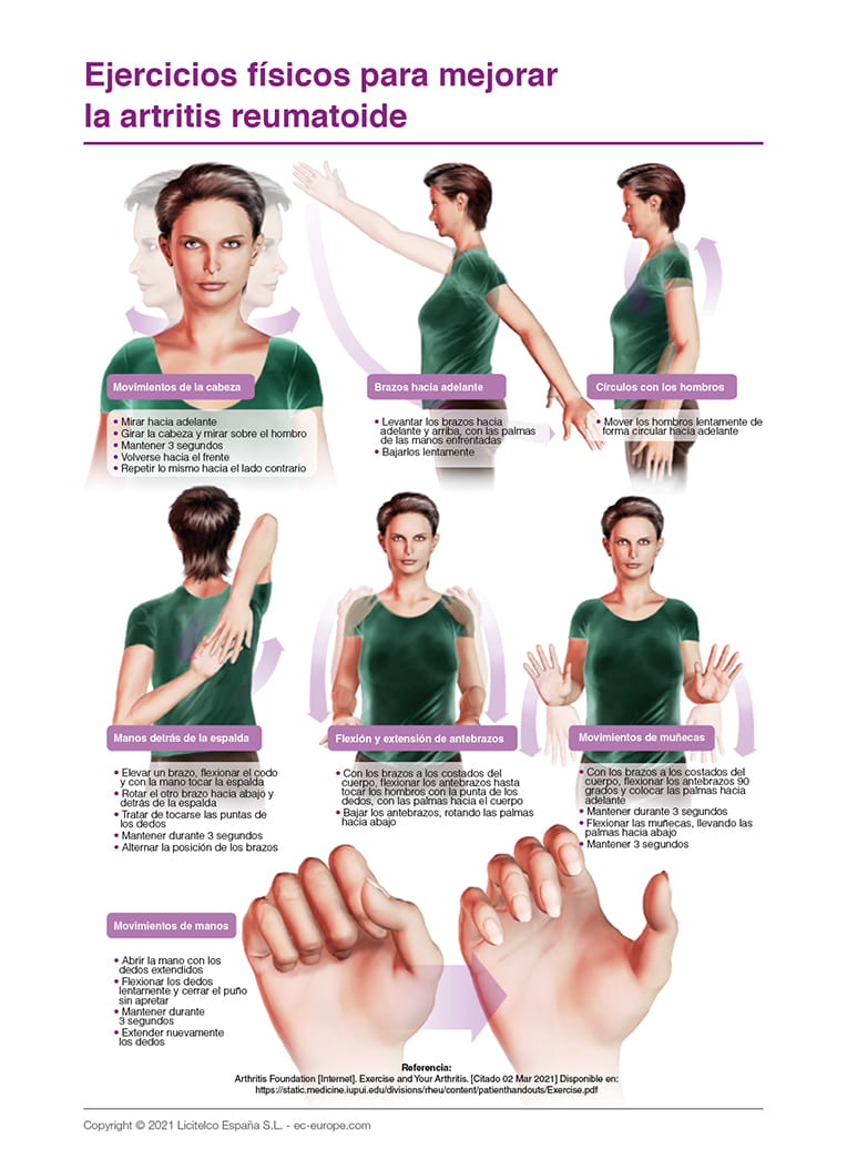 Ejercicios físicos para mejorar la artritis reumatoide