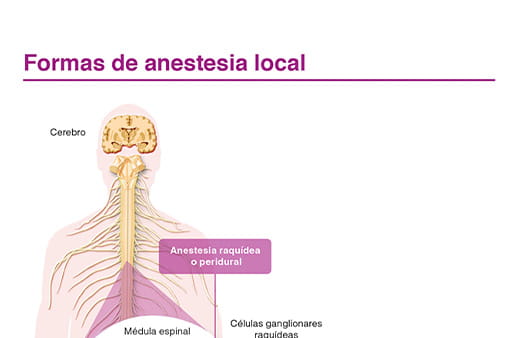 Formas de anestesia local