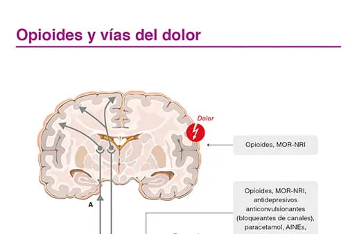 Opioides y vías del dolor