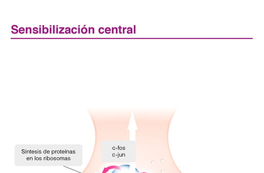 Sensibilización central