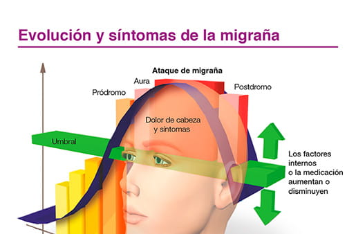 Evolución y síntomas de la migraña