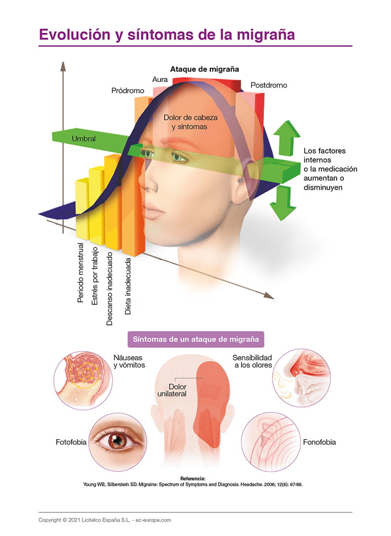 Evolución y síntomas de la migraña