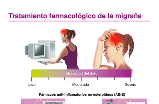 Tratamiento farmacológico de la migraña