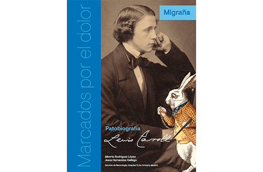 ¿Conoces a estos personajes históricos #MarcadosPorElDolor? Lewis Carroll (Migraña)