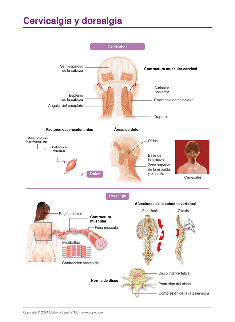 cervicalgia y dorsalgia