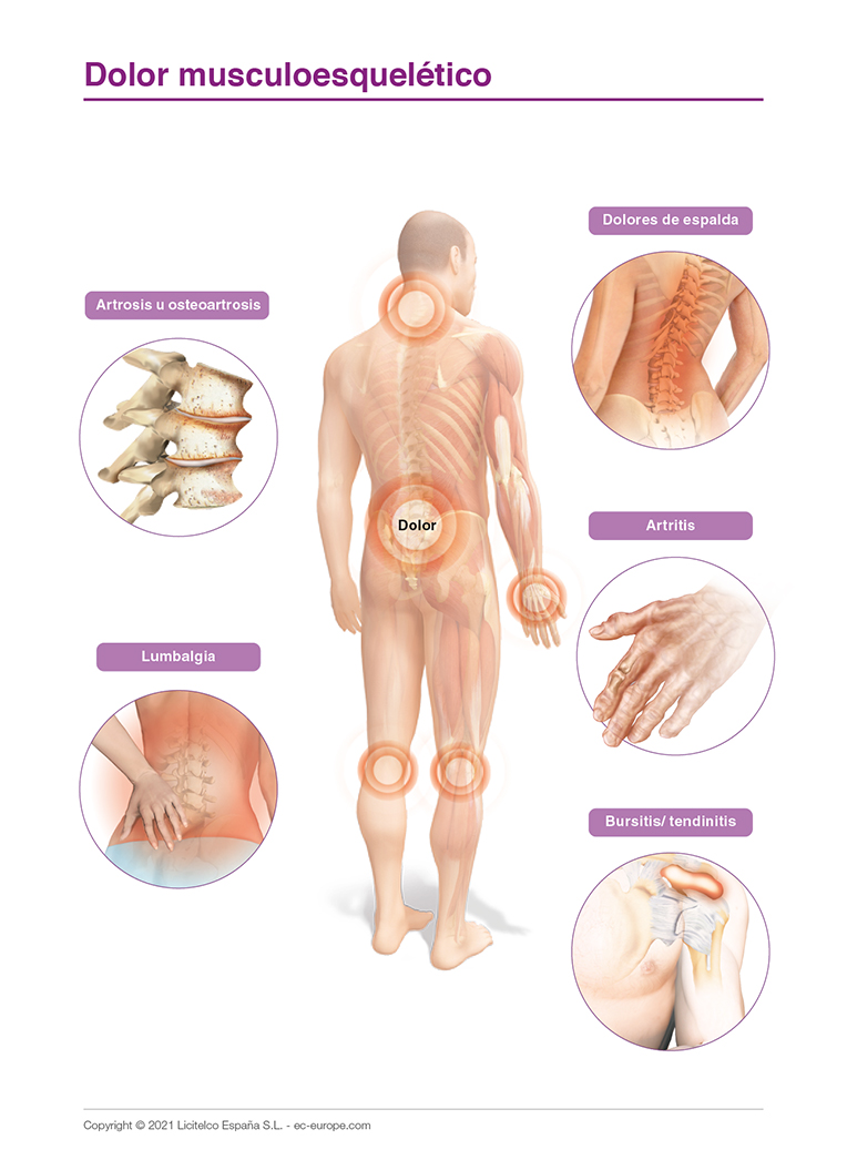 dolor musculo esquelético