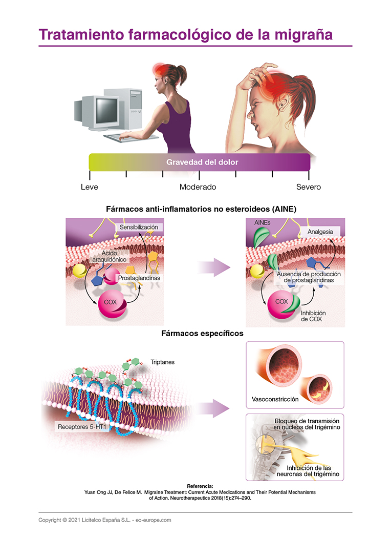 Tratamiento farmacológico de la migraña