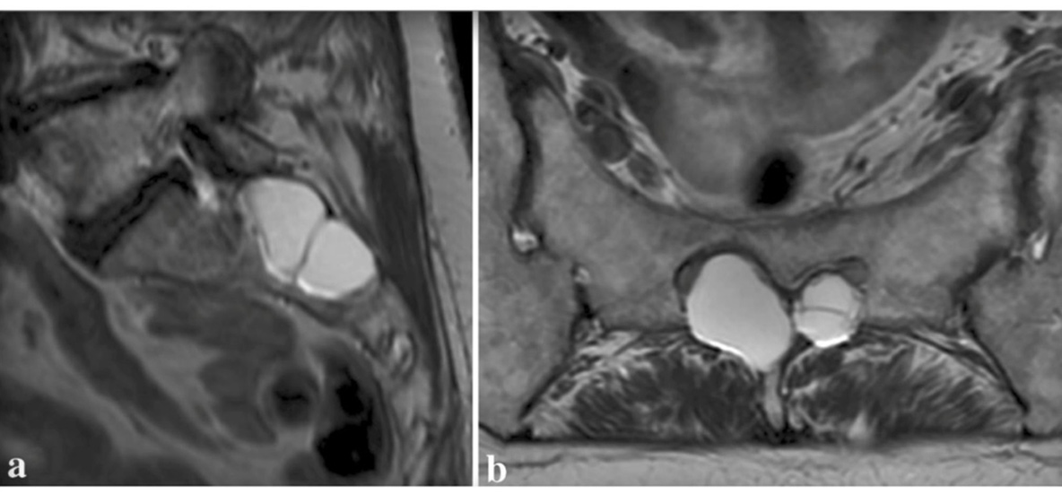 dolor-enfermedades-raras-03