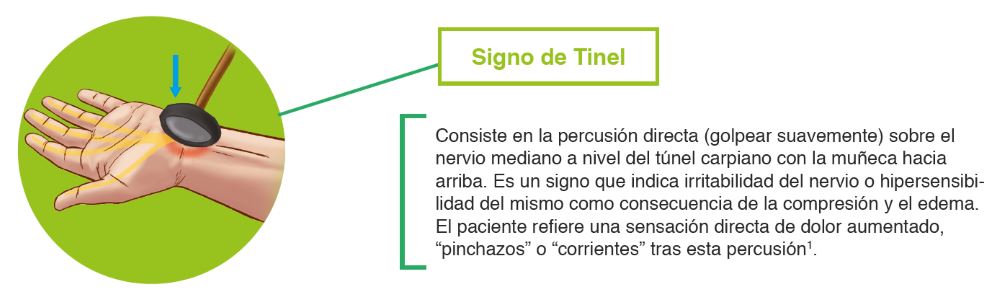 Signo de Tinel