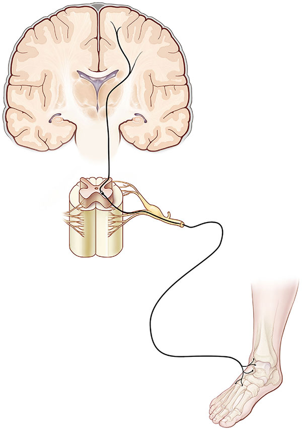 Mecanismos y características del dolor nociplástico