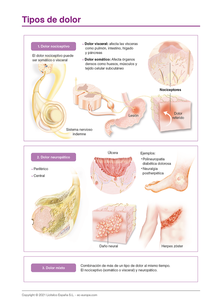 tipos de dolor: dolor nociceptivo, neuropatico, dolor mixto